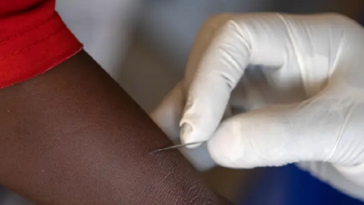 OMS deja claro que el virus mpox no se compara con la Covid-19 4