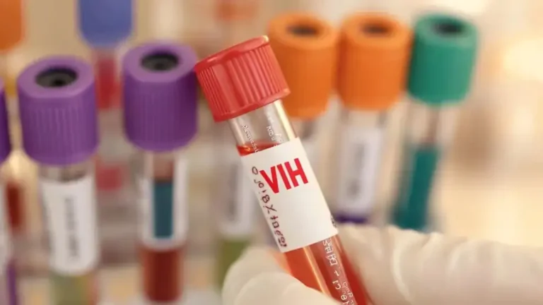 Despidos masivos en Ministerio de Salud argentino afectan lucha contra el VIH 1 un 45 de los nuevos casos de vih en argentina llegan tarde al diagnostico 1955640