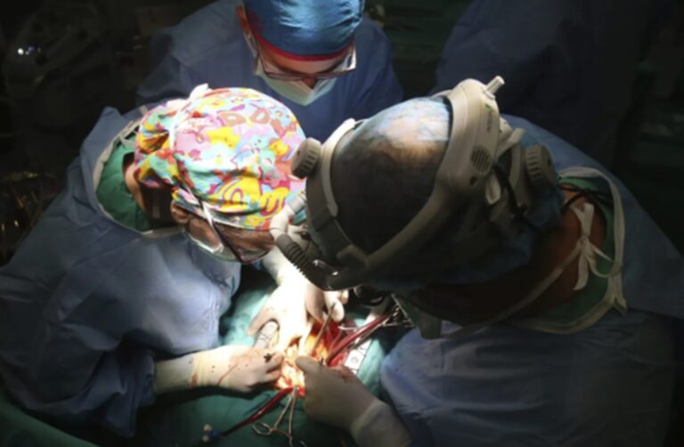 Médicos trasplantando EFE